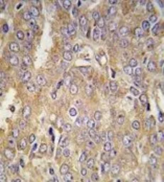 Anti-LTBP1 antibody, C-term used in IHC (Paraffin sections) (IHC-P). GTX81296