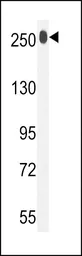 Anti-LTBP1 antibody, C-term used in Western Blot (WB). GTX81296