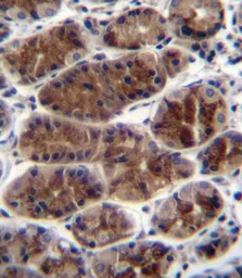 Anti-CTGF antibody, Internal used in IHC (Paraffin sections) (IHC-P). GTX81297