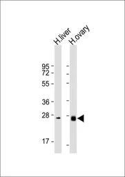 Anti-Neurotrophin 3 antibody, C-term used in Western Blot (WB). GTX81308