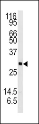 Anti-Neurotrophin 3 antibody, C-term used in Western Blot (WB). GTX81308