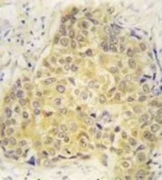 Anti-Semaphorin 3A antibody, Internal used in IHC (Paraffin sections) (IHC-P). GTX81310