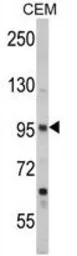Anti-Semaphorin 3A antibody, Internal used in Western Blot (WB). GTX81310