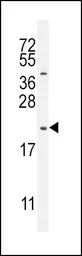 Anti-GHRH antibody, N-term used in Western Blot (WB). GTX81311