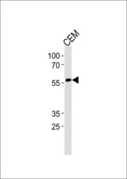 Anti-RUNX2 antibody used in Western Blot (WB). GTX81326