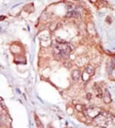 Anti-TNK1 antibody, Internal used in IHC (Paraffin sections) (IHC-P). GTX81327