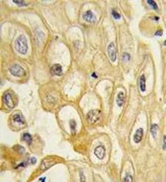 Anti-ROR1 antibody used in IHC (Paraffin sections) (IHC-P). GTX81334