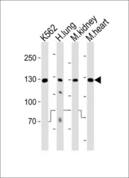 Anti-ROR1 antibody used in Western Blot (WB). GTX81334