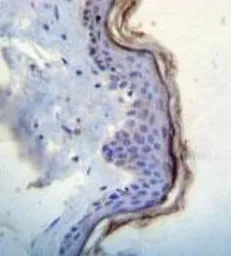 Anti-c-Kit antibody, N-term used in IHC (Paraffin sections) (IHC-P). GTX81335