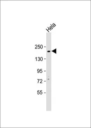 Anti-c-Kit antibody, N-term used in Western Blot (WB). GTX81335