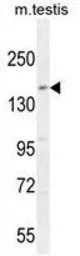 Anti-c-Kit antibody, N-term used in Western Blot (WB). GTX81335
