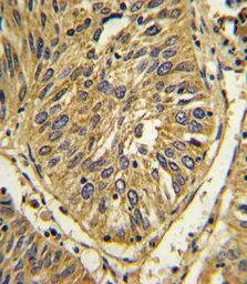 Anti-FGFR2 antibody used in IHC (Paraffin sections) (IHC-P). GTX81341