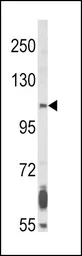 Anti-FGFR2 antibody used in Western Blot (WB). GTX81341