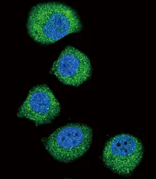 Anti-FGFR2 antibody used in Immunocytochemistry/ Immunofluorescence (ICC/IF). GTX81341