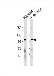 Anti-FGFR2 antibody, N-term used in Western Blot (WB). GTX81342