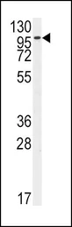 Anti-FGFR2 antibody, N-term used in Western Blot (WB). GTX81342