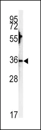 Anti-Carbonic Anhydrase III antibody, N-term used in Western Blot (WB). GTX81343