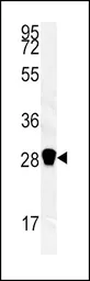 Anti-Carbonic Anhydrase III antibody, N-term used in Western Blot (WB). GTX81343