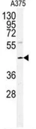 Anti-POLDIP2 antibody, Internal used in Western Blot (WB). GTX81346