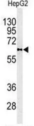Anti-PLTP antibody, C-term used in Western Blot (WB). GTX81352