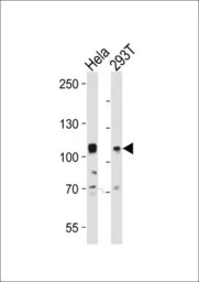 Anti-EphA10 antibody, N-term used in Western Blot (WB). GTX81357