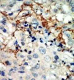 Anti-EphA3 antibody, N-term used in IHC (Paraffin sections) (IHC-P). GTX81361