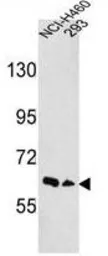 Anti-EphA3 antibody, N-term used in Western Blot (WB). GTX81361