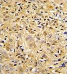 Anti-LUM antibody, Internal used in IHC (Paraffin sections) (IHC-P). GTX81362