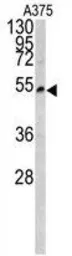Anti-LUM antibody, Internal used in Western Blot (WB). GTX81362