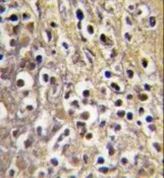Anti-Aromatase antibody, C-term used in IHC (Paraffin sections) (IHC-P). GTX81387