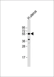 Anti-Aromatase antibody, C-term used in Western Blot (WB). GTX81387