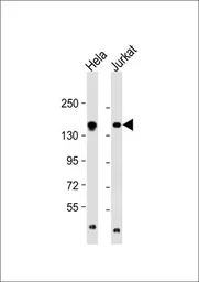 Anti-EPRS antibody, N-term used in Western Blot (WB). GTX81390