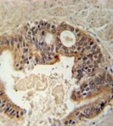 Anti-DYRK1A antibody, N-term used in IHC (Paraffin sections) (IHC-P). GTX81398