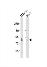 Anti-DYRK1A antibody, N-term used in Western Blot (WB). GTX81398