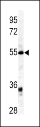 Anti-GDF6 antibody, C-term used in Western Blot (WB). GTX81418