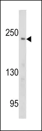 Anti-PCM1 antibody, Internal used in Western Blot (WB). GTX81421
