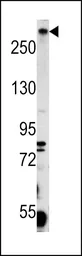 Anti-PCM1 antibody, C-term used in Western Blot (WB). GTX81422