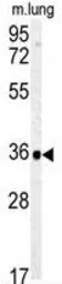 Anti-Carbonic anhydrase IV antibody, C-term used in Western Blot (WB). GTX81426
