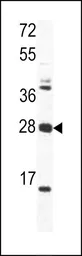 Anti-OAZ1 antibody, N-term used in Western Blot (WB). GTX81427