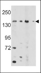 Anti-OPLAH antibody, N-term used in Western Blot (WB). GTX81428