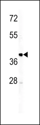 Anti-IGHM antibody, N-term used in Western Blot (WB). GTX81430