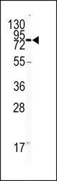 Anti-CD31 antibody, C-term used in Western Blot (WB). GTX81432