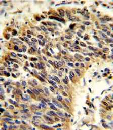 Anti-Vitronectin antibody, N-term used in IHC (Paraffin sections) (IHC-P). GTX81434