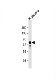 Anti-Vitronectin antibody, N-term used in Western Blot (WB). GTX81434