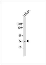 Anti-Vitronectin antibody, N-term used in Western Blot (WB). GTX81434