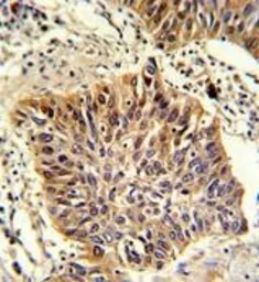 Anti-GOLPH3 antibody, C-term used in IHC (Paraffin sections) (IHC-P). GTX81442