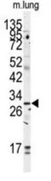 Anti-GOLPH3 antibody, C-term used in Western Blot (WB). GTX81442