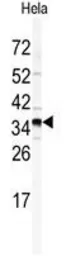 Anti-GOLPH3 antibody, N-term used in Western Blot (WB). GTX81443