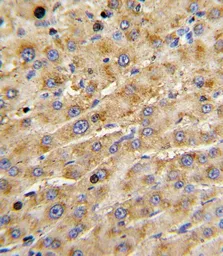 Anti-ADAMTS13 antibody, Internal used in IHC (Paraffin sections) (IHC-P). GTX81447