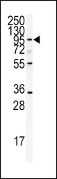 Anti-ADAMTS13 antibody, Internal used in Western Blot (WB). GTX81447